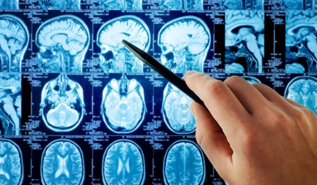 A magnetic resonance image (MRI) of the human brain. (File photo credit: Triff via Shutterstock)